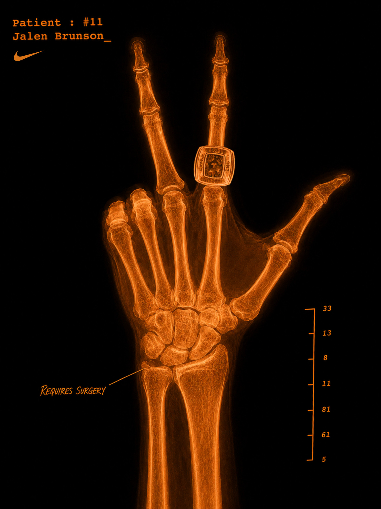 Jalen Brunson X-Ray Graphic